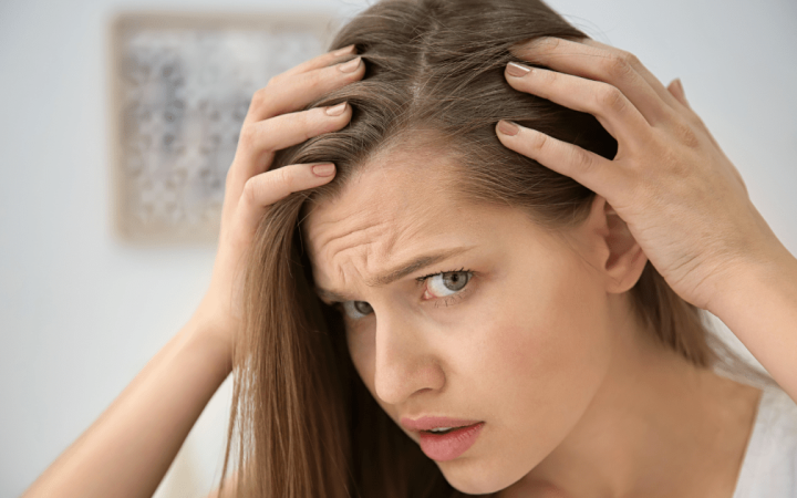 Female Pattern Baldness - matritva care